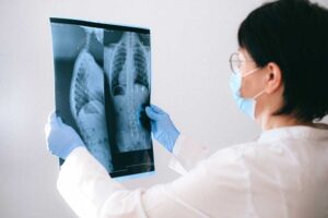 doctor examining a lung x-ray